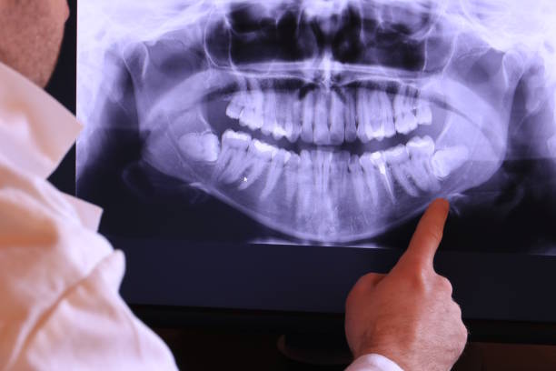 Best Emergency Broken Tooth Repair in Old Fig Garden, CA