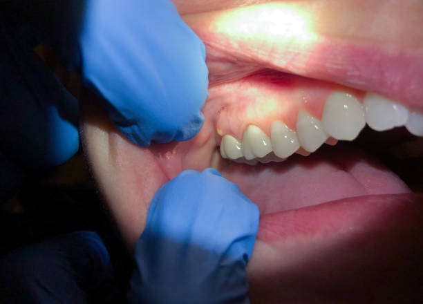 Best Urgent Dental Care in Old Fig Garden, CA